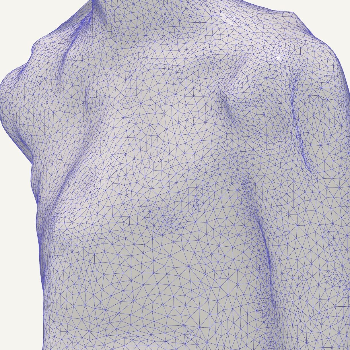 Tratamiento para Pectus Carinatum en adolescentes